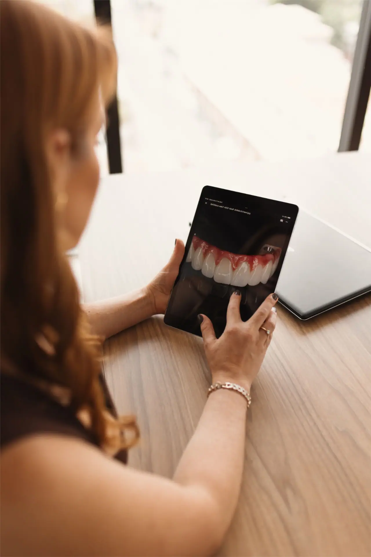 Tablet smile preview